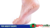 শীতে পায়ের যত্ন নেবেন যেভাবে