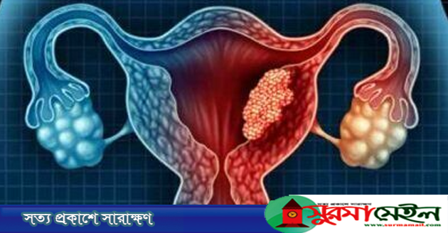 জরায়ুমুখের ক্যান্সারের লক্ষণ
