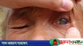 নিরাময়যোগ্য অন্ধত্ব নিরসন করতে হবে