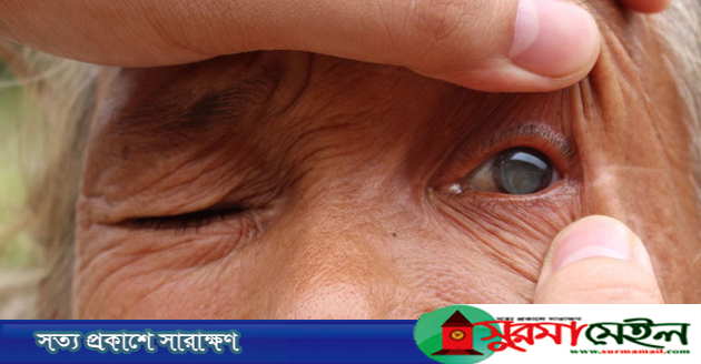 নিরাময়যোগ্য অন্ধত্ব নিরসন করতে হবে