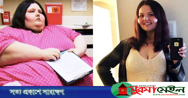৩১৭ কেজি থেকে ঝরঝরে তরুণী, কিন্তু কীভাবে?
