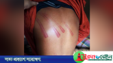 ক্ষুদে শিক্ষার্থীর সঙ্গে মাদ্রাসা শিক্ষকের এ কেমন বর্বরতা!