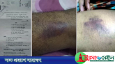 গোয়াইনঘাটে চোরাকারবারি হোছন কর্তৃক এক ব্যক্তির উপর হামলা, আদালতে মামলা