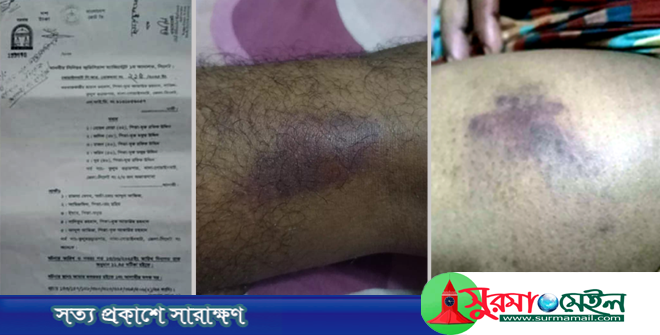 গোয়াইনঘাটে চোরাকারবারি হোছন কর্তৃক এক ব্যক্তির উপর হামলা, আদালতে মামলা