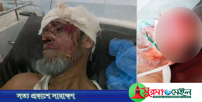 খাদিমপাড়ায় ছাত্রলীগ কর্মীর ইটের আঘাতে বিএনপি নেতা খুন