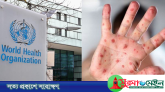 হামের উচ্চ ঝুঁকিতে বাংলাদেশ: ডব্লিউএইচও