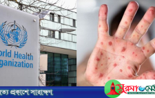 হামের উচ্চ ঝুঁকিতে বাংলাদেশ: ডব্লিউএইচও