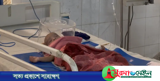 সিলেটে হামের উপসর্গে আরও ৩ শিশুর প্রাণহানি