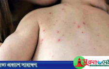 সিলেটে হাম উপসর্গ নিয়ে আরও দুই শিশুর মৃত্যু