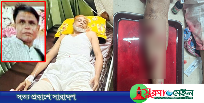 সিলেটে চাঁদা না দেওয়ায় চিকিৎসকের উপর হামলা, আহত ৩