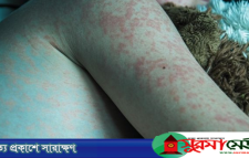 সিলেটে হাম উপসর্গে আরও দুই শিশুর মৃত্যু